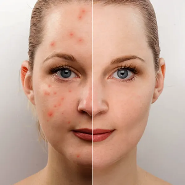 Skin & Scar Treatments