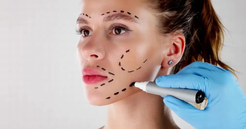 Facial Surgery