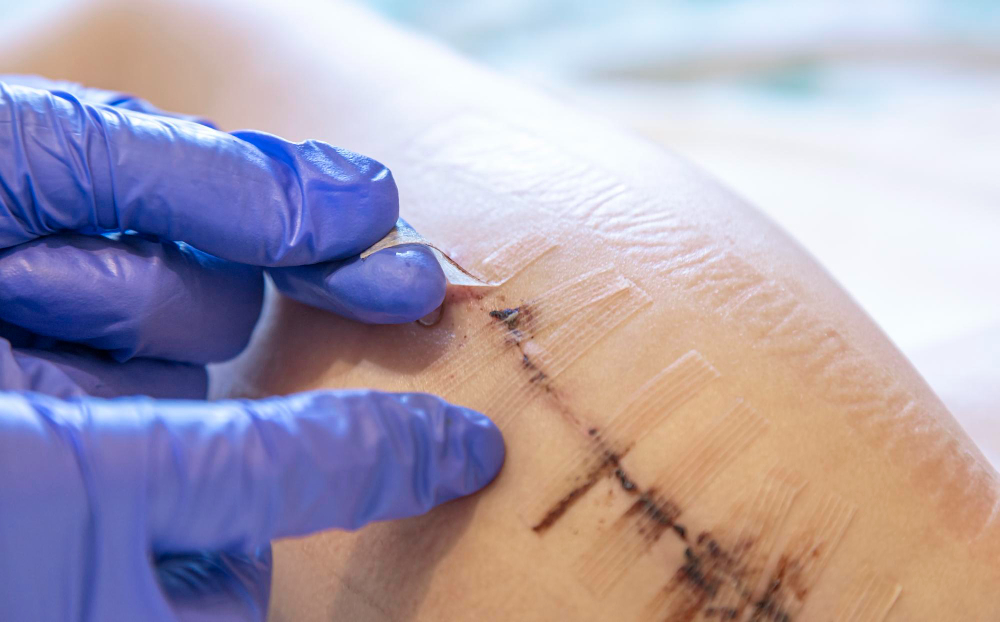 doctor untaping after scan revision surgery