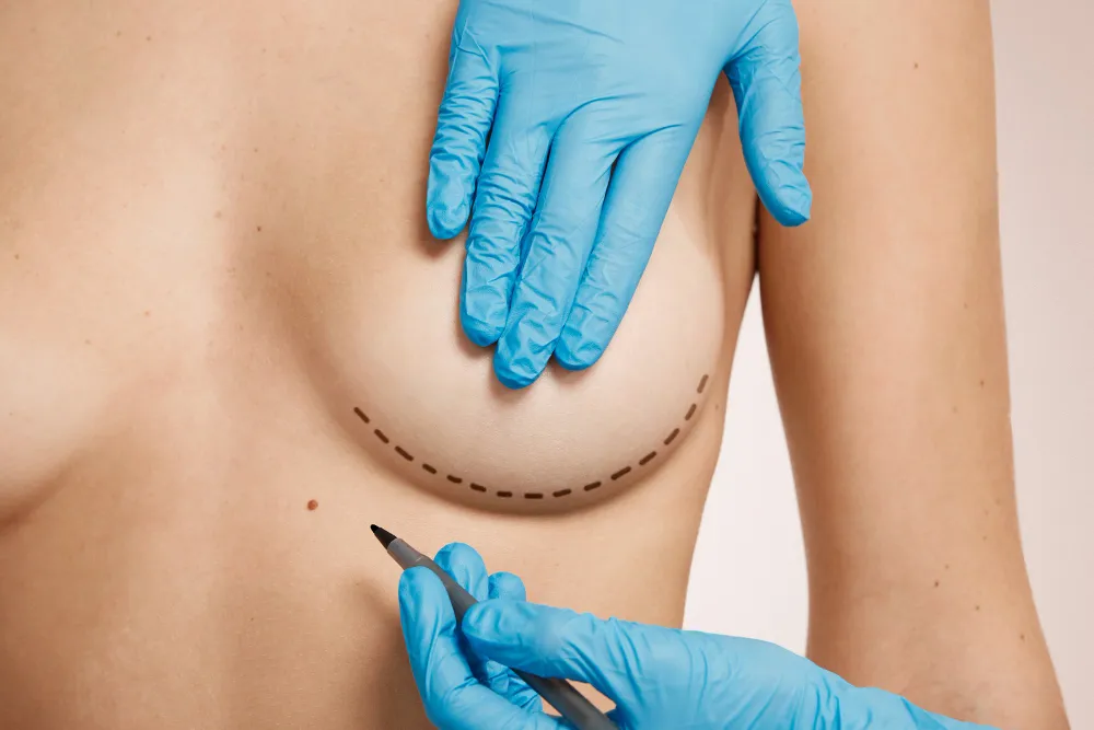 breast reduction surgery
