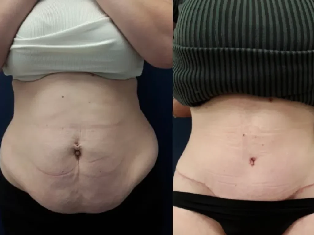 Before and after treatments